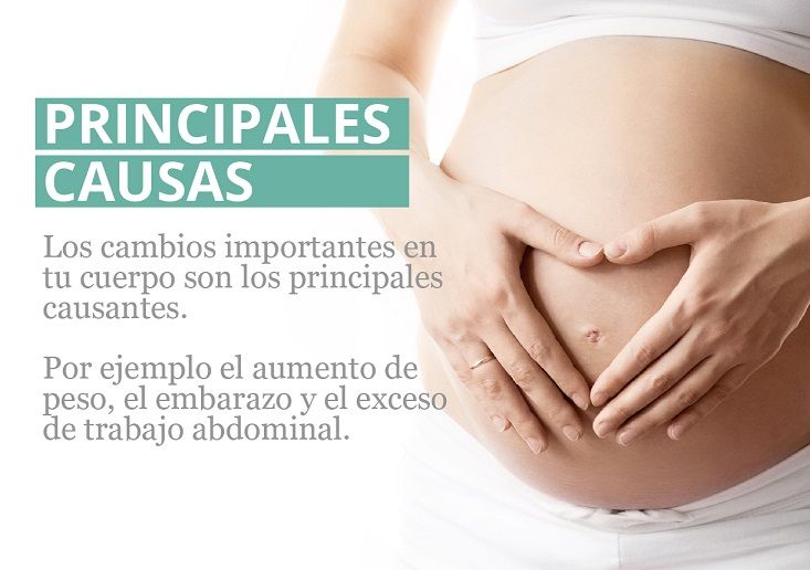 El 100% de las embarazadas sufre Diástasis