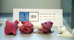 IBV desarrolla ‘biomodelos’ del corazón para simplificar la planificación quirúrgica