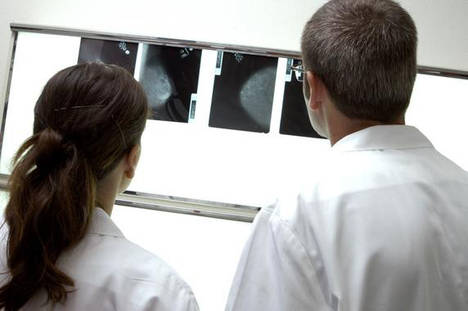 El número total de nuevos casos de cáncer en España en 2015 fue de 247.771 (148.827 en varones y 98.944 en mujeres).