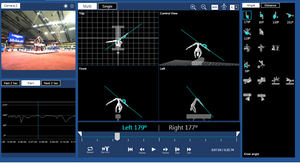 Fujitsu desarrolla una tecnología de digitalización que cuantifica los patrones de la forma de caminar ya que varían según el impacto de diferentes enfermedades