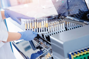 Mejora en el rendimiento de los equipos de laboratorio y diagnóstico gracias a los sistemas de movimiento lineal de NSK